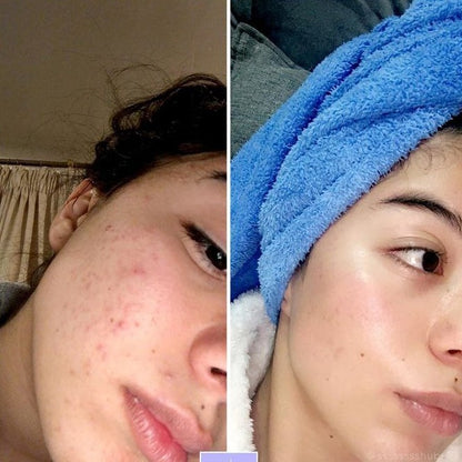Dr. Melaxin™ – Ultimate Skin Care Bundle (6 pcs)